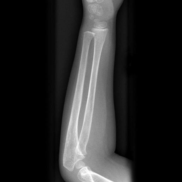 X-ray
