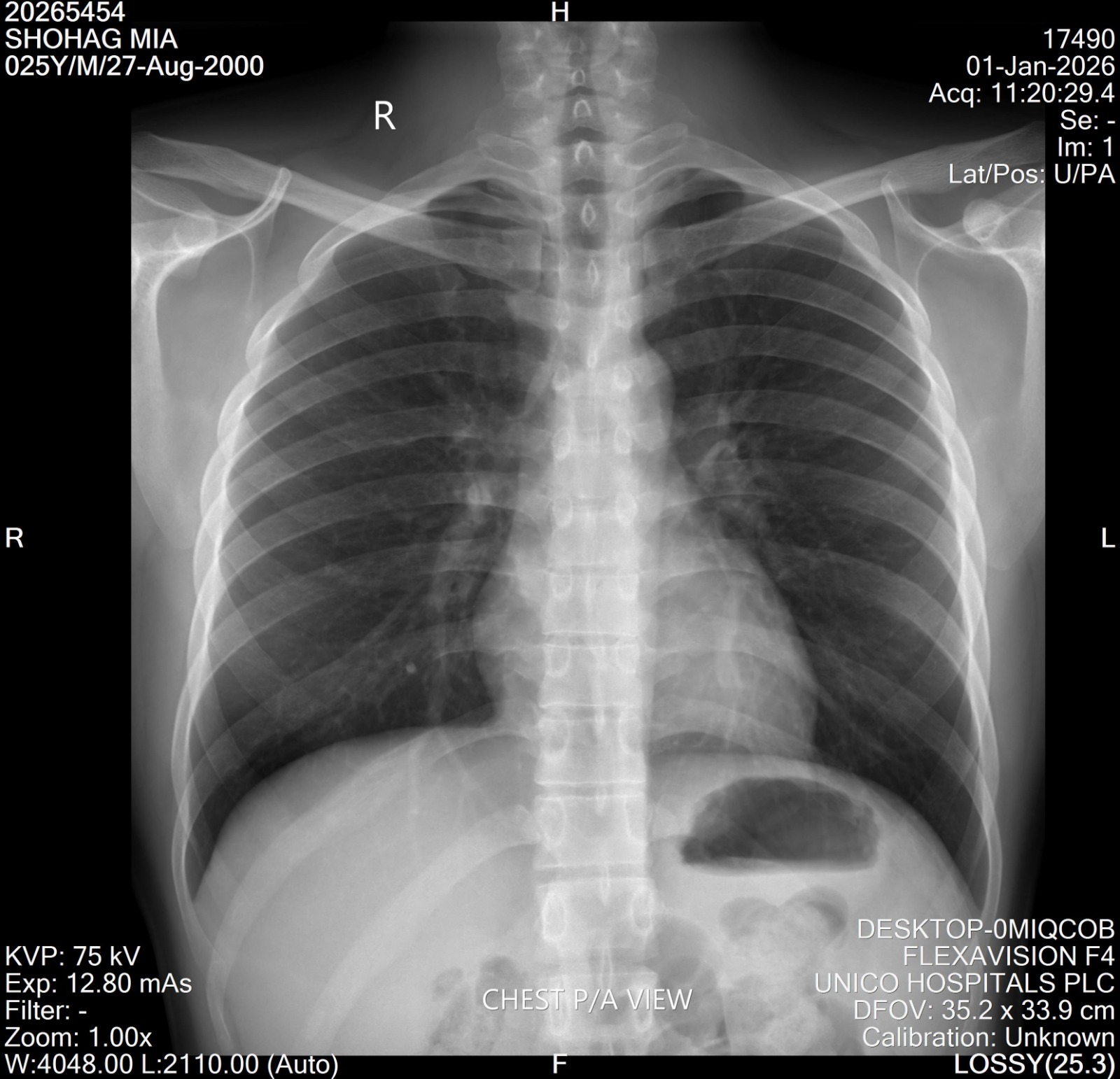 X-ray